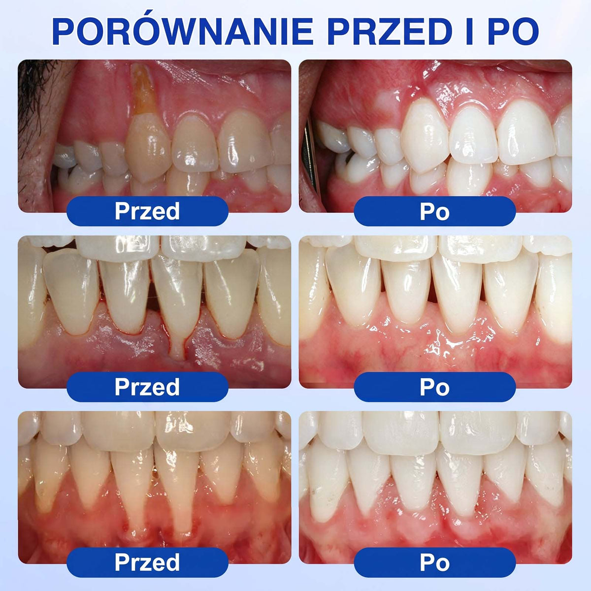 Evolvion® 👩‍⚕️ GumRevive – Zaawansowany żel do zdrowych i mocniejszych dziąseł 🎊