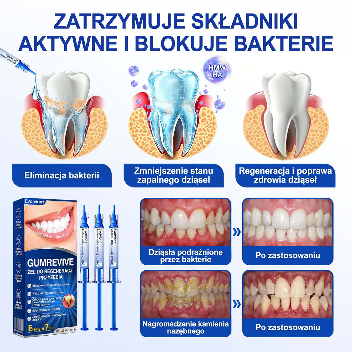 Evolvion® 👩‍⚕️ GumRevive – Zaawansowany żel do zdrowych i mocniejszych dziąseł 🎊