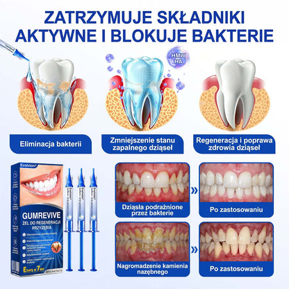 Evolvion® 👩‍⚕️ GumRevive – Zaawansowany żel do zdrowych i mocniejszych dziąseł 🎊