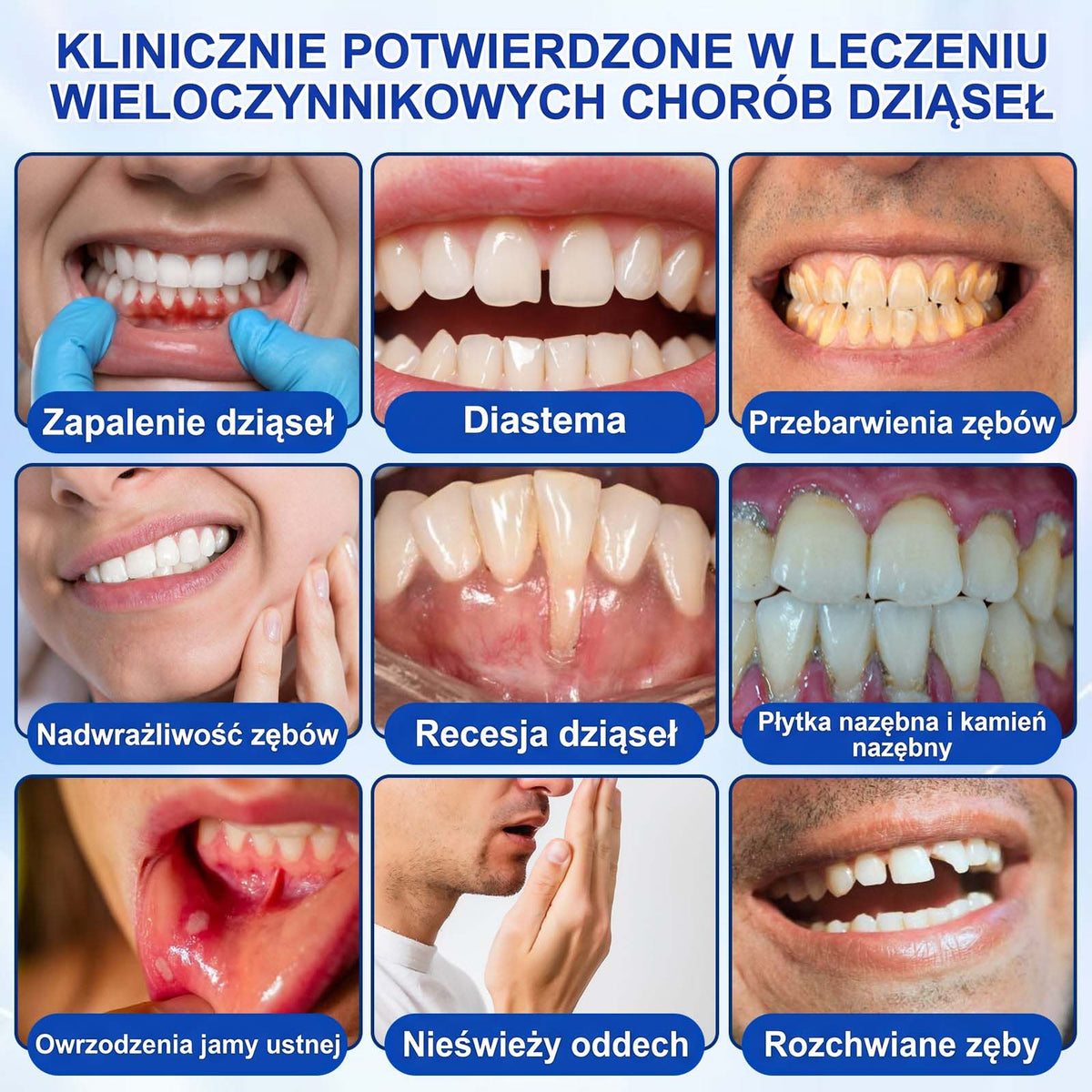 Evolvion® 👩‍⚕️ GumRevive – Zaawansowany żel do zdrowych i mocniejszych dziąseł 🎊