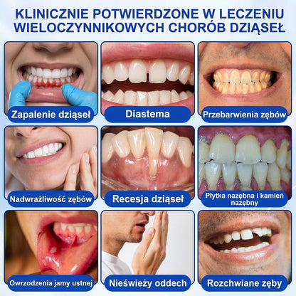 Evolvion® 👩‍⚕️ GumRevive – Zaawansowany żel do zdrowych i mocniejszych dziąseł 🎊