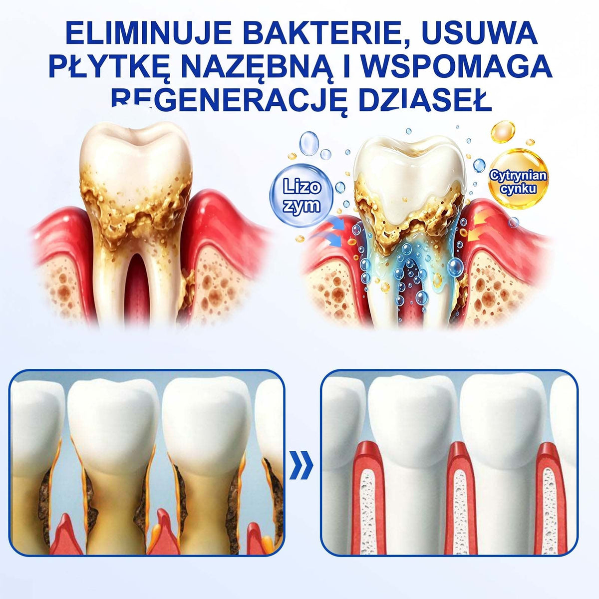 Evolvion® 👩‍⚕️ GumRevive – Zaawansowany żel do zdrowych i mocniejszych dziąseł 🎊