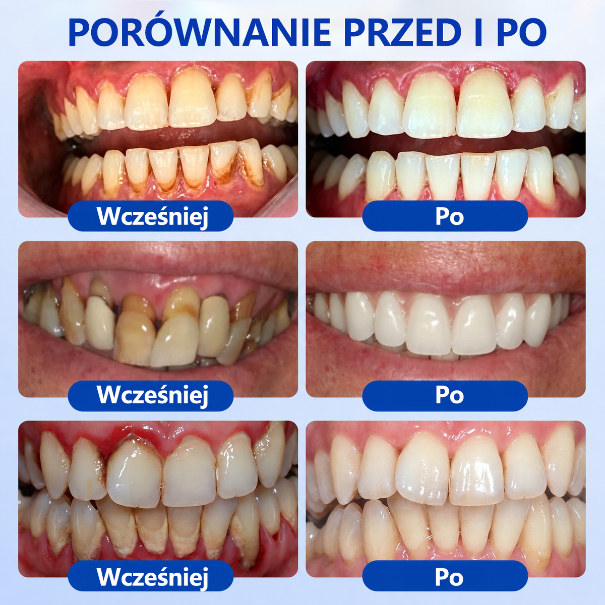 𝐄𝐯𝐨𝐥𝐯𝐢𝐨𝐧® 𝐆𝐮𝐦𝐑𝐞𝐯𝐢𝐯𝐞 Ż𝐞𝐥 𝐝𝐨 𝐫𝐞𝐠𝐞𝐧𝐞𝐫𝐚𝐜𝐣𝐢 𝐩𝐫𝐳𝐲𝐳ę𝐛𝐢𝐚⚡
