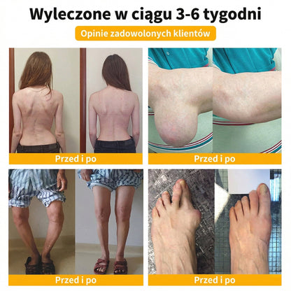 ✅Oficjalny sklep: 𝑭𝑨𝑻𝑶𝑵𝑮® Krem z jadem pszczelim – Uśmierzanie bólu i regeneracja kości 👨‍⚕️ Rekomendowany przez Amerykańską Akademię Chirurgów Ortopedycznych (AAOS) 💖 Oferta specjalna – ograniczony czas