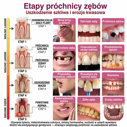 Rolimey® DenPerm – Naturalny żel wypełniający szkliwo do leczenia ubytków próchnicowych🧨