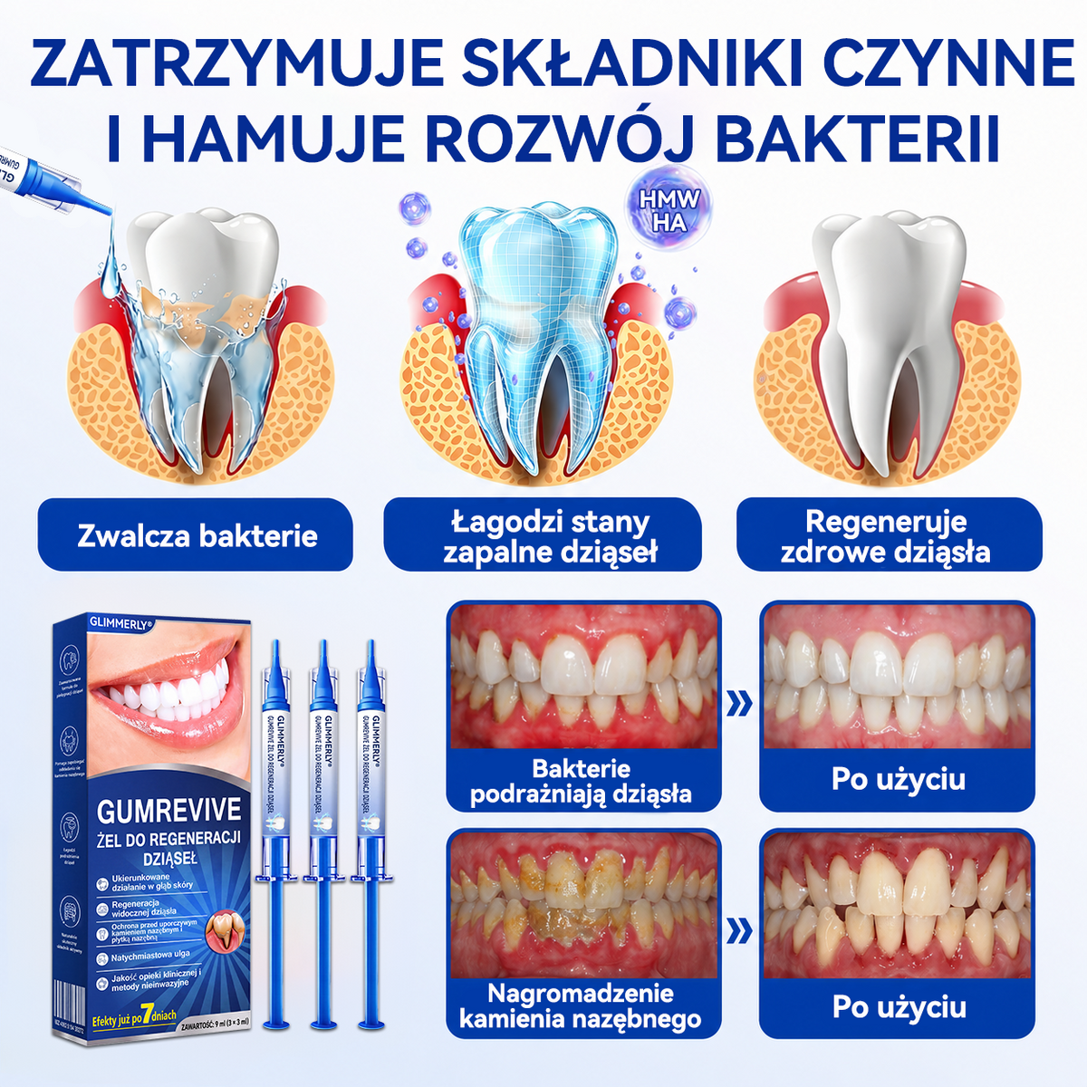 𝐄𝐯𝐨𝐥𝐯𝐢𝐨𝐧® 𝐆𝐮𝐦𝐑𝐞𝐯𝐢𝐯𝐞 Ż𝐞𝐥 𝐝𝐨 𝐫𝐞𝐠𝐞𝐧𝐞𝐫𝐚𝐜𝐣𝐢 𝐩𝐫𝐳𝐲𝐳ę𝐛𝐢𝐚⚡