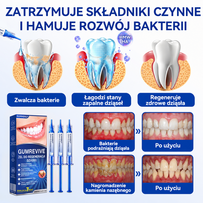 𝐄𝐯𝐨𝐥𝐯𝐢𝐨𝐧® 𝐆𝐮𝐦𝐑𝐞𝐯𝐢𝐯𝐞 Ż𝐞𝐥 𝐝𝐨 𝐫𝐞𝐠𝐞𝐧𝐞𝐫𝐚𝐜𝐣𝐢 𝐩𝐫𝐳𝐲𝐳ę𝐛𝐢𝐚⚡