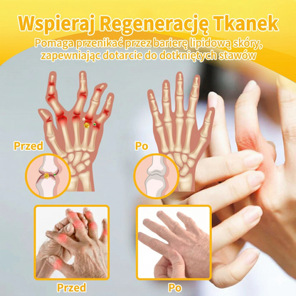 ✅Oficjalny sklep: 𝑭𝑨𝑻𝑶𝑵𝑮® Krem z jadem pszczelim – Uśmierzanie bólu i regeneracja kości 👨‍⚕️ Rekomendowany przez Amerykańską Akademię Chirurgów Ortopedycznych (AAOS) 💖 Oferta specjalna – ograniczony czas