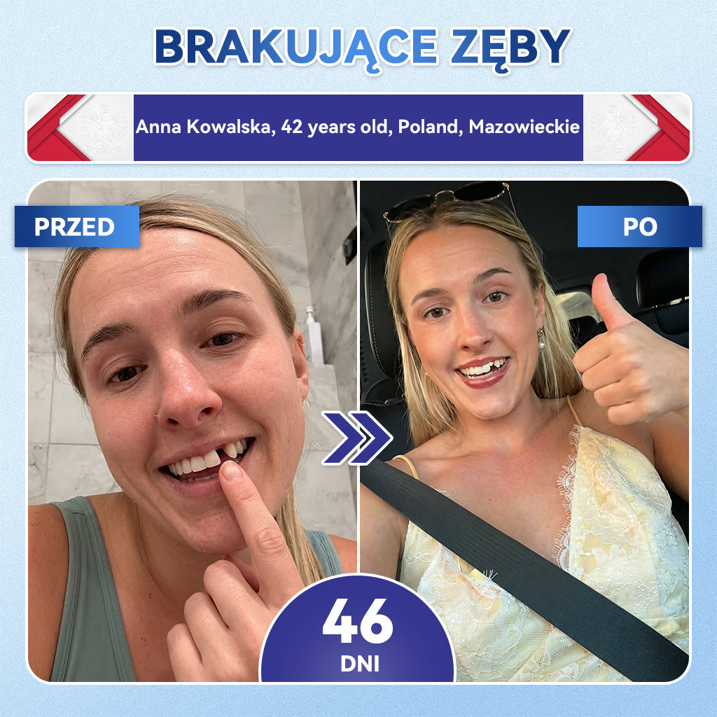🦷 𝐆𝐥𝐢𝐦𝐦𝐞𝐫𝐥𝐲® 𝐓𝐢𝐝𝐞𝐠𝐥𝐮𝐬𝐢𝐛 Płatki Mikronakłuwające do Naprawy Zębów i Dziąseł | Zaawansowana Aktywacja Komórek Macierzystych – Strips do Naprawy Zębów