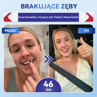 🦷 𝐆𝐥𝐢𝐦𝐦𝐞𝐫𝐥𝐲® 𝐓𝐢𝐝𝐞𝐠𝐥𝐮𝐬𝐢𝐛 Płatki Mikronakłuwające do Naprawy Zębów i Dziąseł | Zaawansowana Aktywacja Komórek Macierzystych – Strips do Naprawy Zębów