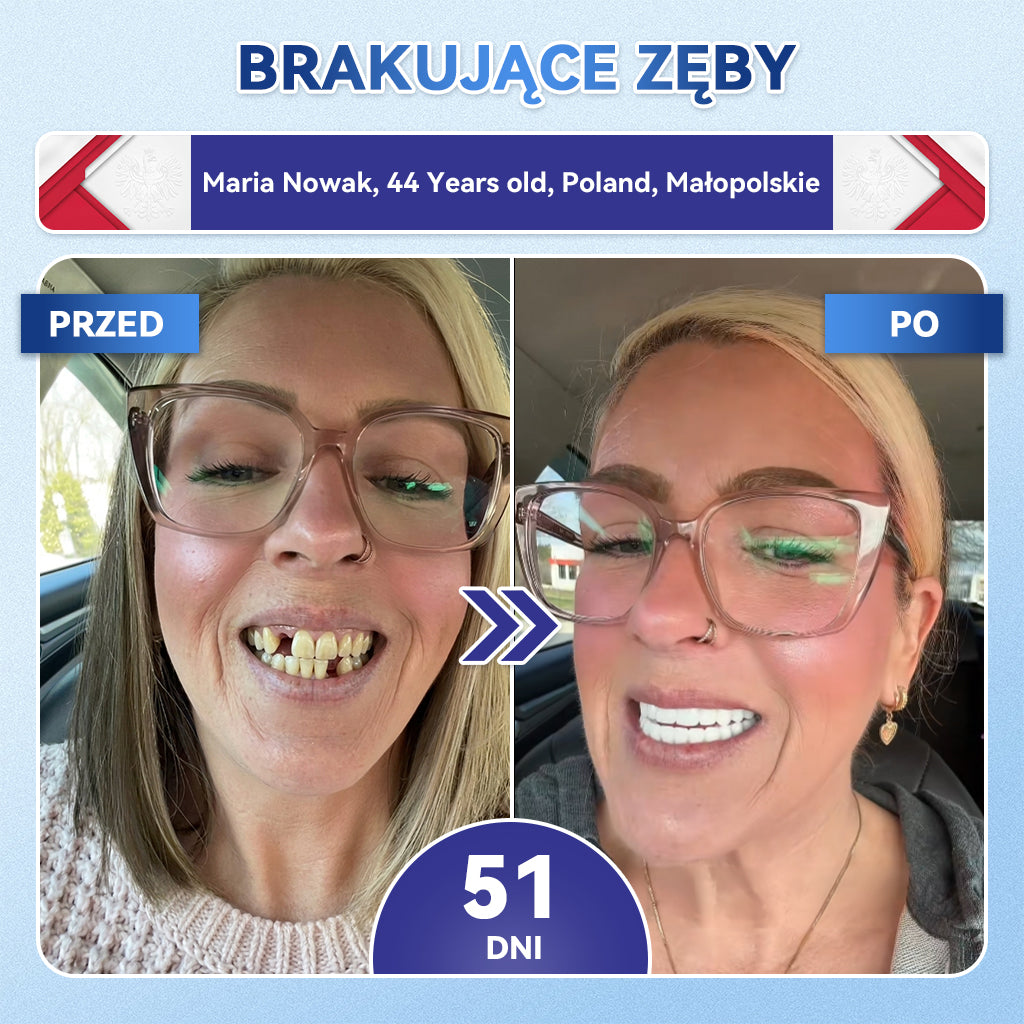 🦷 𝐆𝐥𝐢𝐦𝐦𝐞𝐫𝐥𝐲® 𝐓𝐢𝐝𝐞𝐠𝐥𝐮𝐬𝐢𝐛 Płatki Mikronakłuwające do Naprawy Zębów i Dziąseł | Zaawansowana Aktywacja Komórek Macierzystych – Strips do Naprawy Zębów