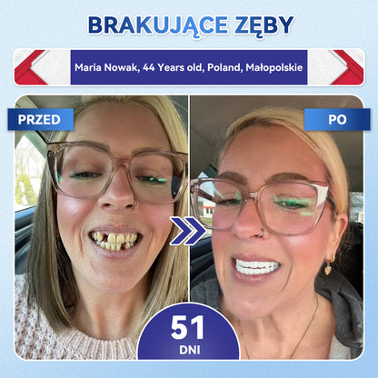 🦷 𝐆𝐥𝐢𝐦𝐦𝐞𝐫𝐥𝐲® 𝐓𝐢𝐝𝐞𝐠𝐥𝐮𝐬𝐢𝐛 Płatki Mikronakłuwające do Naprawy Zębów i Dziąseł | Zaawansowana Aktywacja Komórek Macierzystych – Strips do Naprawy Zębów