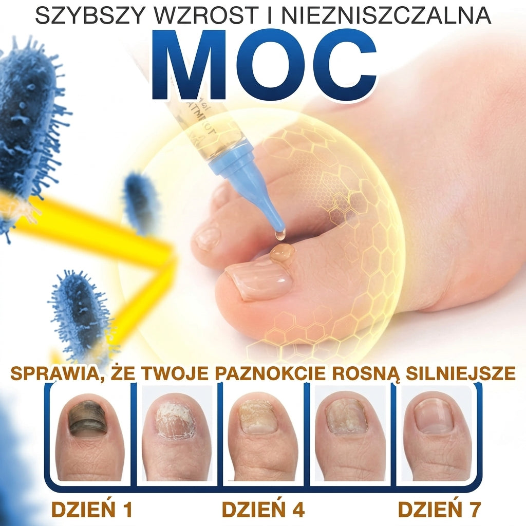 🇪🇺 Certyfikowany w UE 👩‍🔬 CareBreeze® Fungi Free – Intensywna Kuracja do Paznokci na Bazie Jadu Pszczelego 🍼