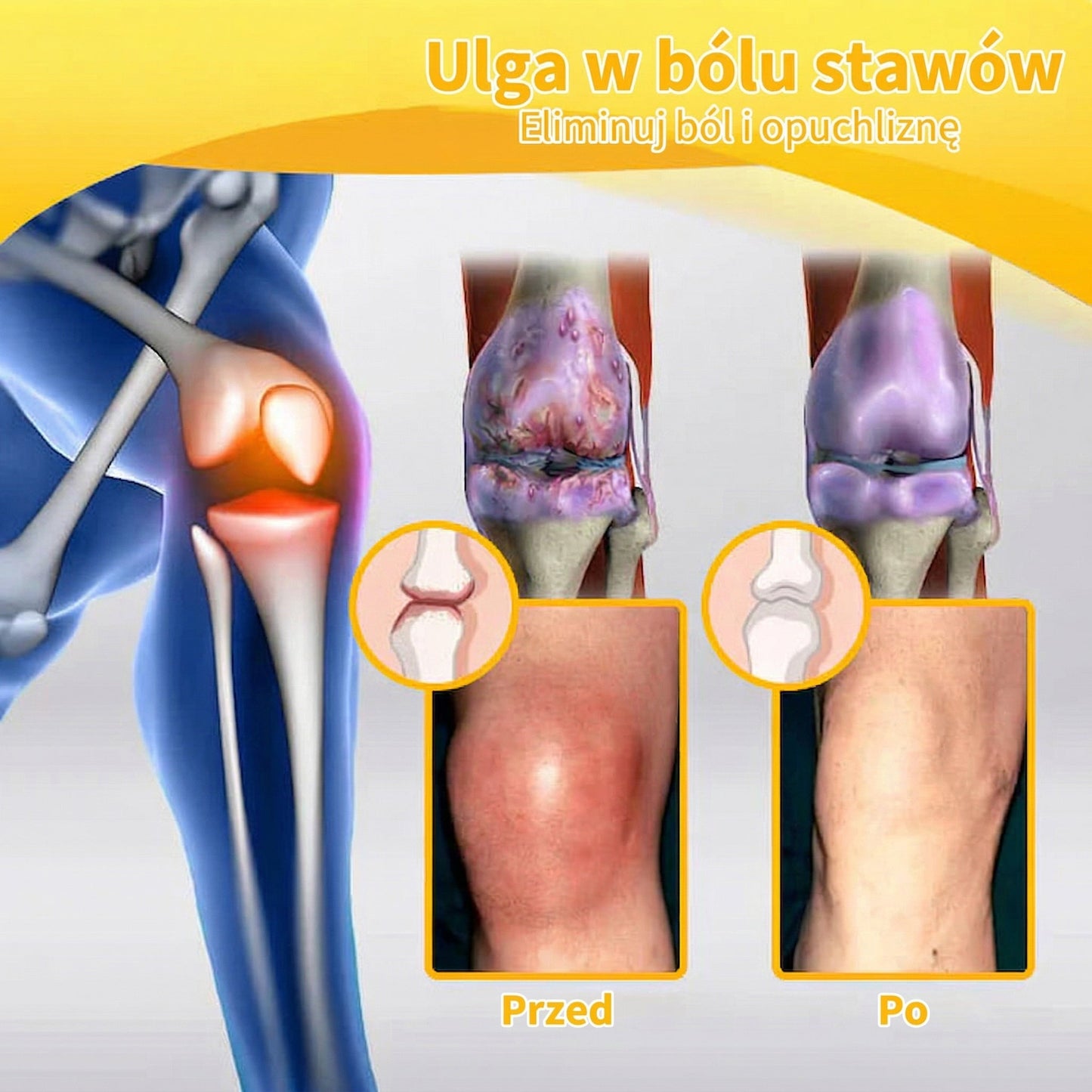 ✅Oficjalny sklep: 𝑭𝑨𝑻𝑶𝑵𝑮® Krem z jadem pszczelim – Uśmierzanie bólu i regeneracja kości 👨‍⚕️ Rekomendowany przez Amerykańską Akademię Chirurgów Ortopedycznych (AAOS) 💖 Oferta specjalna – ograniczony czas
