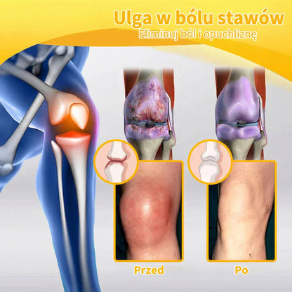✅Oficjalny sklep: 𝑭𝑨𝑻𝑶𝑵𝑮® Krem z jadem pszczelim – Uśmierzanie bólu i regeneracja kości 👨‍⚕️ Rekomendowany przez Amerykańską Akademię Chirurgów Ortopedycznych (AAOS) 💖 Oferta specjalna – ograniczony czas