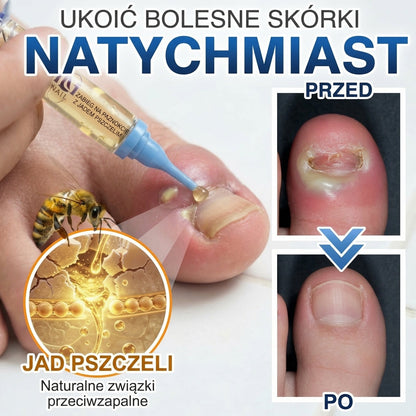 🇪🇺 Certyfikowany w UE 👩‍🔬 CareBreeze® Fungi Free – Intensywna Kuracja do Paznokci na Bazie Jadu Pszczelego 🍼