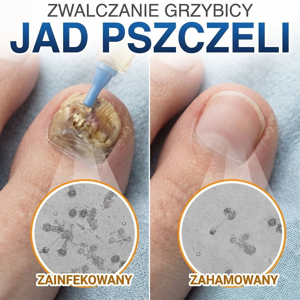 🇪🇺 Certyfikowany w UE 👩‍🔬 CareBreeze® Fungi Free – Intensywna Kuracja do Paznokci na Bazie Jadu Pszczelego 🍼