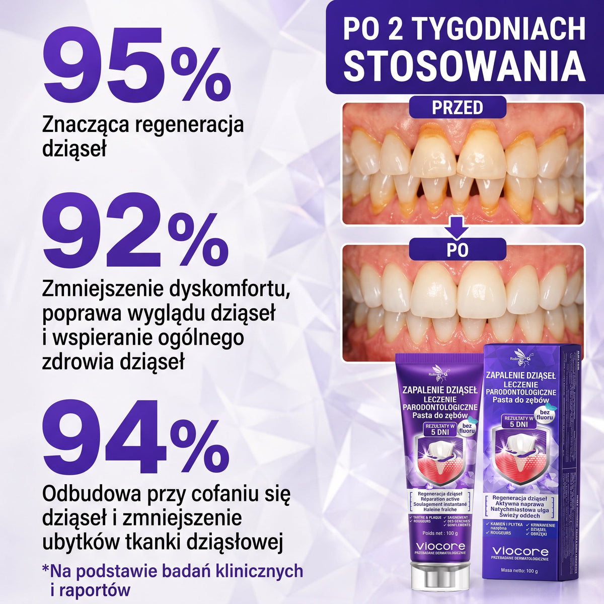 🦷 Rolimey® VioCore™ |  Zaawansowana pielęgnacja dziąseł i zębów 🍇