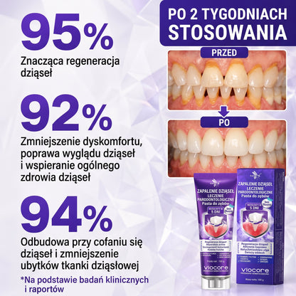 🦷 Rolimey® VioCore™ |  Zaawansowana pielęgnacja dziąseł i zębów 🍇