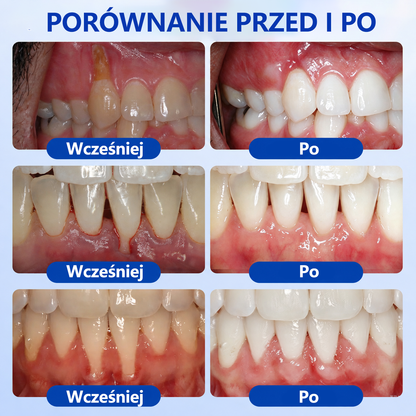 𝐄𝐯𝐨𝐥𝐯𝐢𝐨𝐧® 𝐆𝐮𝐦𝐑𝐞𝐯𝐢𝐯𝐞 Ż𝐞𝐥 𝐝𝐨 𝐫𝐞𝐠𝐞𝐧𝐞𝐫𝐚𝐜𝐣𝐢 𝐩𝐫𝐳𝐲𝐳ę𝐛𝐢𝐚⚡